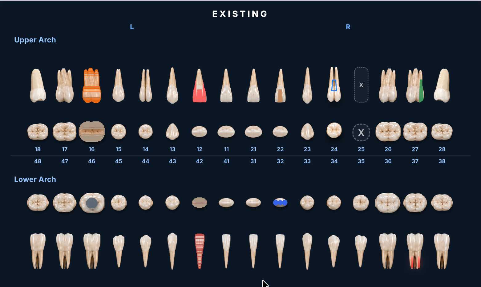 See the full mouth in one clear clinical chart