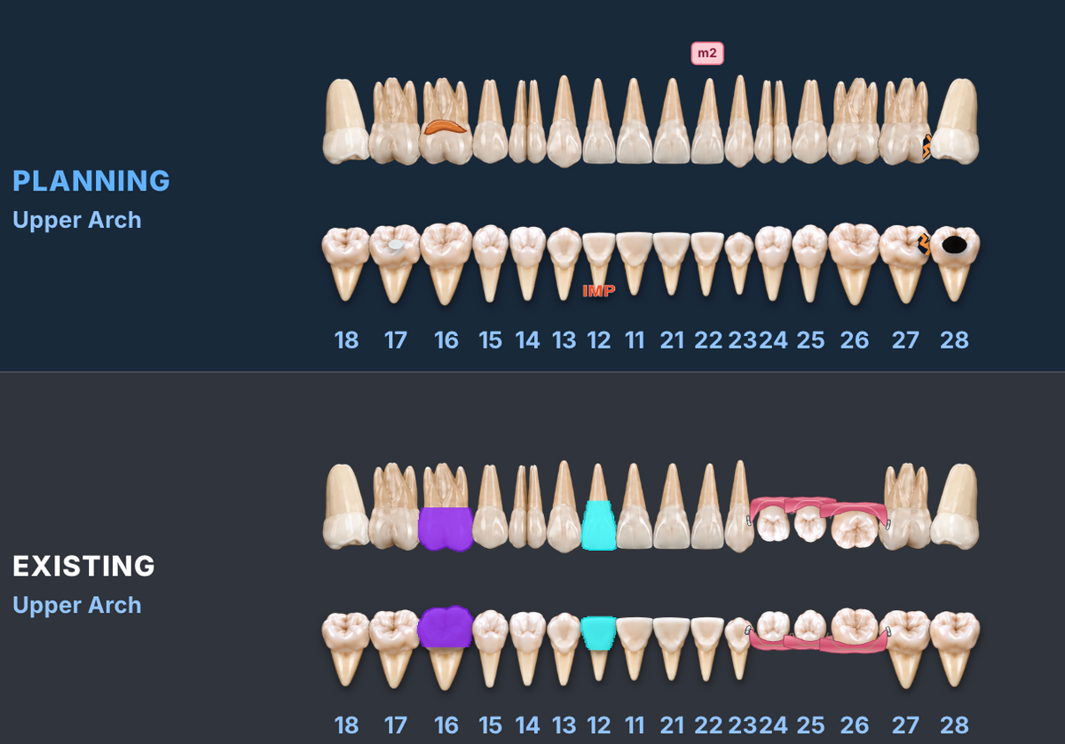 See the full mouth in one clear clinical chart
